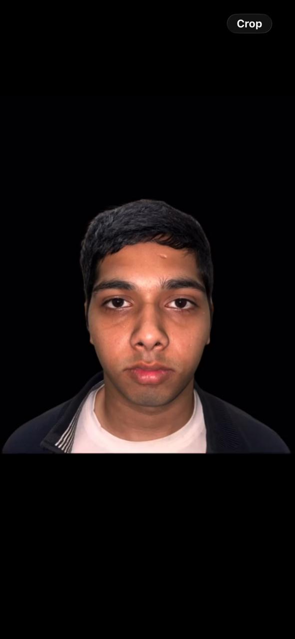 Before Treatment - Facial Profile & Chin Alignment Realignment