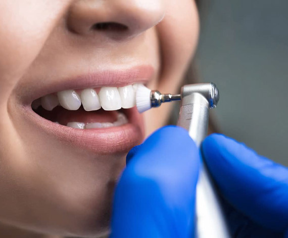 Scaling & Teeth Polishing